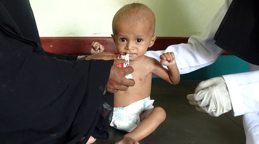 Haiyan Saeed, un enfant yéménite de 18 mois souffrant de malnutrition et pesant quatre kilogrammes, est nourri dans un centre de traitement de la malnutrition dans la province occidentale de Hudaydah, le 6 novembre 2021. (Photo d'archive de l'AFP)